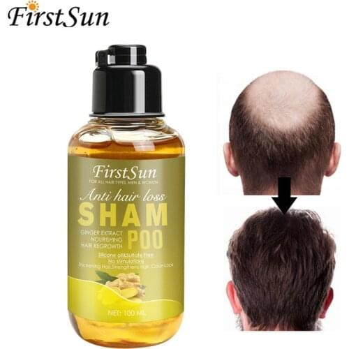 FirstSun Anti Hair Loss Shampoo Herbal Ginger Ginseng Extract Hair Essence Treatment Dry Frizz Regrowth Thicken Hair Product