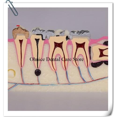 Oral teaching model Molar cross section study model M4009/dental cavity Molar cross Tooth Model/Dental Lab tooth model