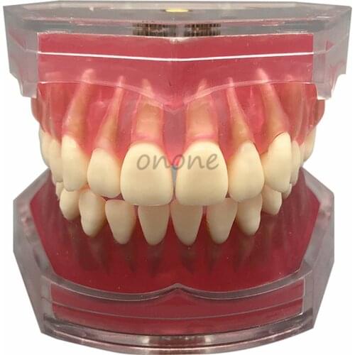 Dental Standard Model with Removable Teeth Dental Study Teach Teeth Model