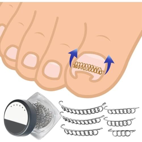 12PCS Ingrown toenail corrector Tool Pedicure Recover Embed Toe Nail Treatment professional Ingrown toenail correction Foot Care