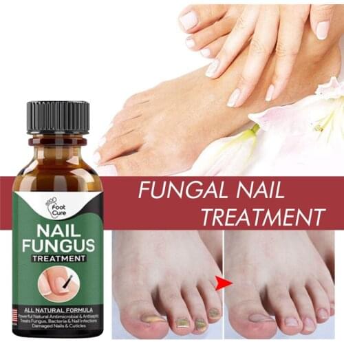 Foot Anti-fungal Essence To Remove Onychomycosis Repair Treatment Liquid Healthy Nail Care Repair Liquid Nourishment Oil 1bottle