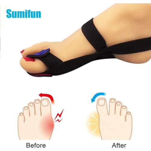 2pcs Big Toe Corrector Toes Separator With Magnetic Belt Hallux Valgus Bunion Orthopedic Pain Relieving Straightener Foot Care
