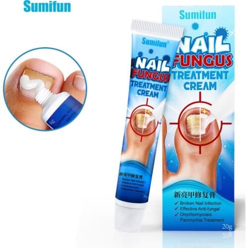 20g Nail Fungus Fungal Removal Cream Treatment Infection Toenails Care Against Fungus Onychomycosis Soft Nail Ointment