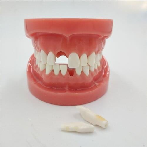 Dental All teeth Removable Standard Teeth Tooth Model 28 pcs teeth student learning