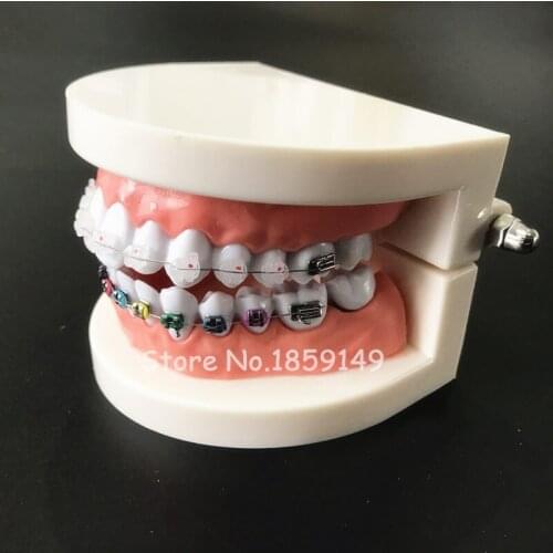 1pc Dental Orthodontic Treatment Model With Ortho Metal Ceramic Bracket Arch Wire Buccal Tube Ligature Ties