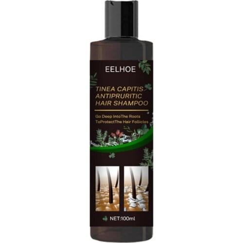 Shampoo Lotion Universal Moisturizing Shampoo Hair Products Oil Control Effective Anti-dandruff Hair Shampoo Lotion