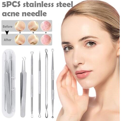 5 Piece Tool Set for Blackhead Remover Acne Extractor Removal Tool for Acne Pimples SANA889