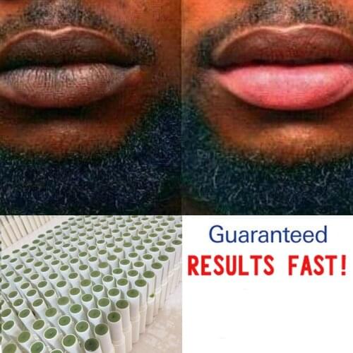 1PC Lips Pink Fresh Lightening Bleaching Cream Treatment Remove Dark Smoke Lips Lip Balm