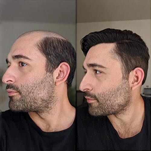 Fine Mono Mens Hair Replacement System Invisible knot natural hairline men toupee 6" Human Hair Toupee Mono Wig for Men