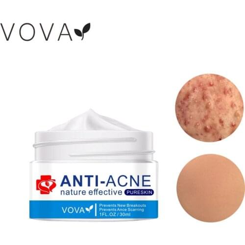 VOVA Acne Cream Pimple Acne Treatment Anti-acne Acne Scar Removal Anti Inflammation Oil Control Whitening Acne Repair Skin Care