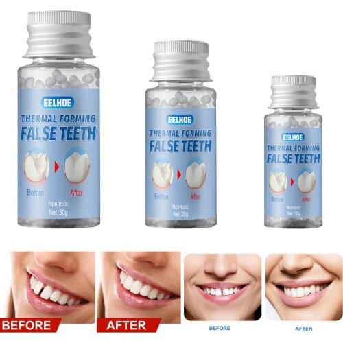 1Bottle Thermal Fitting Beads Teeth Veneers Moldable Temporary Tooth Repair Kit for Fix the Missing Tooth Teaching