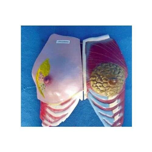 Female Breast Model Health and Sick Breast Anatomy Model Female Genital Anatomical Model Pathological Breast Medical Teaching
