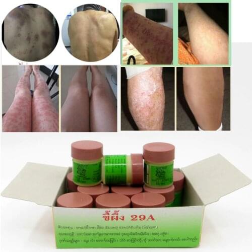 24Piece Chinese Ointment Psoriasi Eczma Cream Works Perfect For All Kinds Of Skin Problems Patch 12