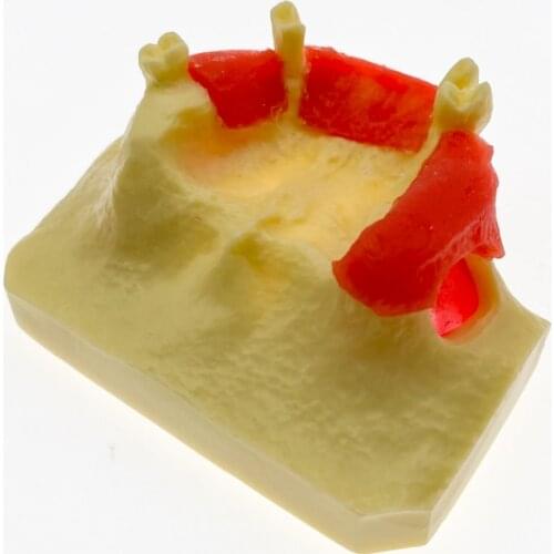 NEW Dental Sinus Lift Practice Teeth Model Typodont Study Model 2013 01