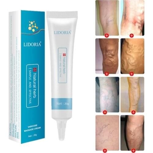 1PCS Natural herbal medicine for treating varicose vascular inflammation massage cream cure varicose vein ointment