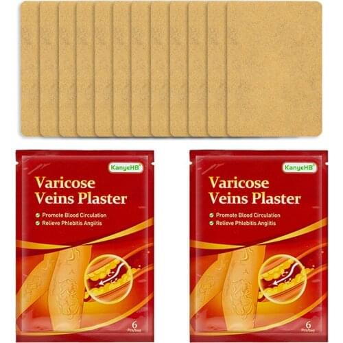 2Bag Chinese Varicose Vein Plaster Vasculitis Phlebitis Spider Leg Medical Patch