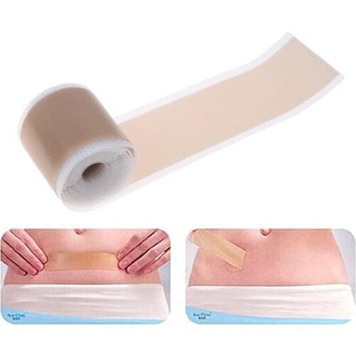 Efficient Surgery Scar Removal Silicone Gel Sheet Therapy Patch For Acne Trauma Burn Scar Skin Repair Scar Treatment 4x150cm