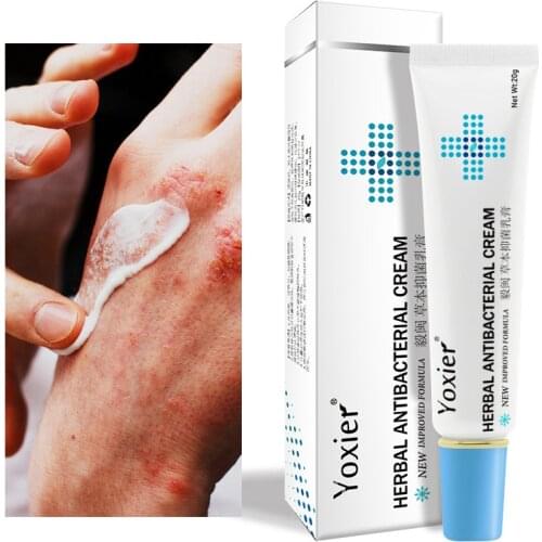 Kruiden Eczeem Psoriasis Crme Antibacterile Dermatitis Behandeling Anti-Jeuk Opluchting Huiduitslag Irritatie Allergien