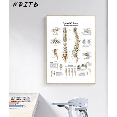Human Spinal Column Anatomy Canvas Wall Art Poster Print Skeletal System Medicine Pathology Picture Painting Study Room Decor