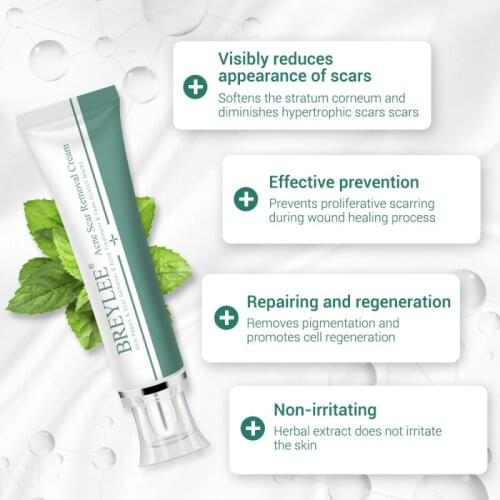 30ml Herbal Remove Scare Cream Face Boby Leg Cream Skin Care Pimples Scar Stretch Marks Removal Whitening Smooth Skin