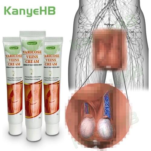 3pcs New Arrivals Varicose Veins Ointment Genitals Varicocele Cream Varices Ointment Treatment Spider Veins Removal Cream A641