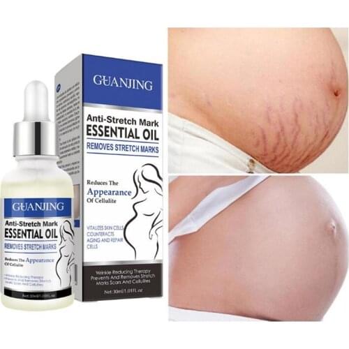 Stretch Marks Removal Essential Oils Pure Natural Stretch Marks Remover Obesity Postpartum Anti-wrinkle Repair Cream Skin Care