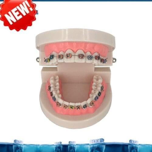 Dental Orthodontic Treatment Model Typodont With Ortho Metal Ceramic Bracket Arch Wire Buccal Tube Ligature Ties teeth model