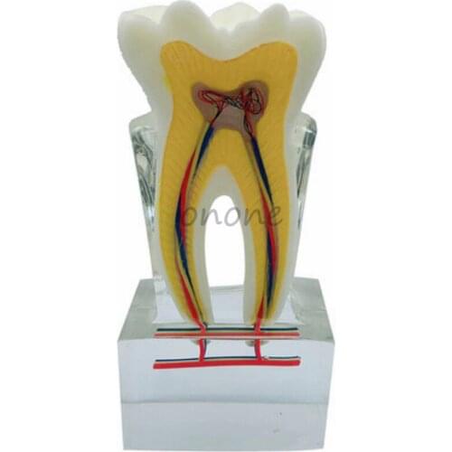 1pcs 6Times Dental Nerve Line Display Model Crystal Tooth Structure Snatomy Teaching model
