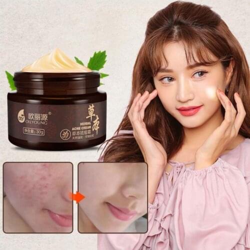 Natrual Herbal Acne Cream Blackhead Removal Cream Essence Anti Pimple Acne Scars Oil Control Whitening Face Care Cream