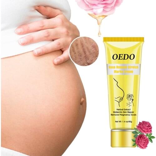 40g Rose Remove Stretch Marks Cream Rose Herbs Restore Necrotic Cells Promote Cell Regeneration Repair Fibers Skin Softer Fair