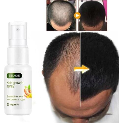 20ml Ginger Nutrient Liquid Spray Hair Growth Spray Regrowth Ginger Spray Epair Damaged Nourish Hair Hair Growth Spray