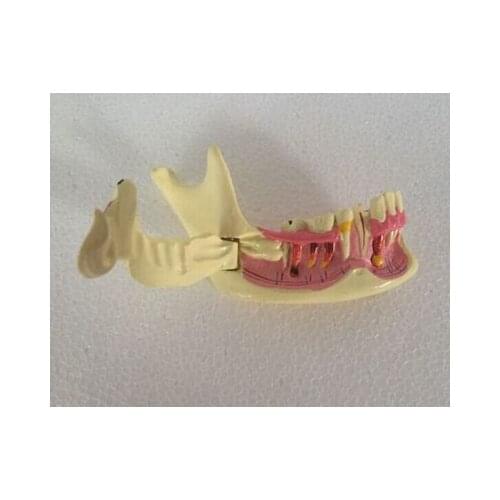 Tooth models right mandibular decomposition model demo model Oral cavity models free shipping