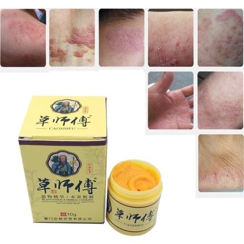 Caoshifu Skin Psoriasis Cream Dermatitis Eczematoid Eczema Ointment Treatment Psoriasis Cream Skin Care Cream