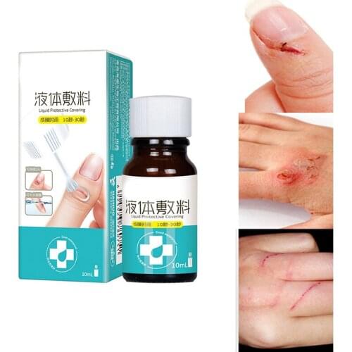 Waterproof Liquid Band 10ml for Adult Kids Transparent Liquid Bandage Plaster Cut Wounds Healing Gel CLH@8