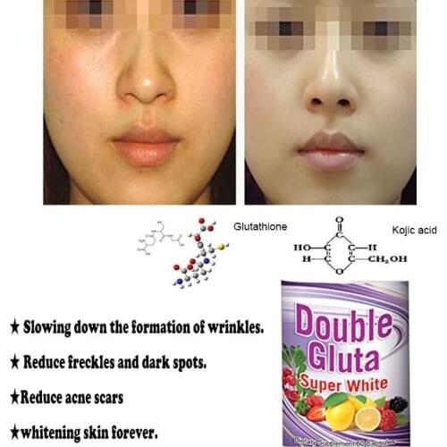 Double Gluta Glutathione Reduce acne scars, freckles and dark spots. Whitening Anti Aging Skin for Women 1bottle