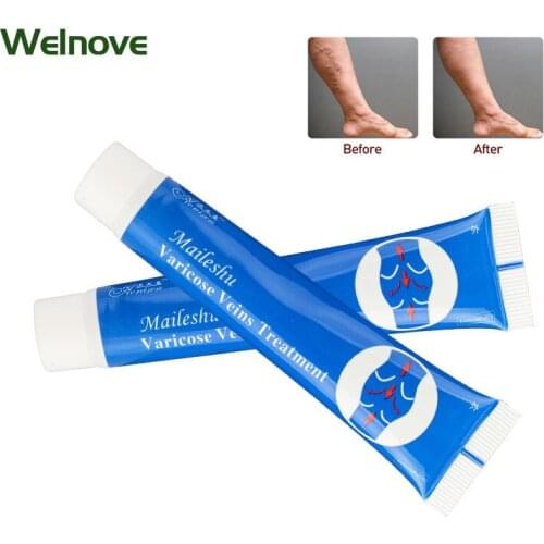 1Pc 25g Chinese Herb Spider Leg Varicose Veins Treatment Cream Relief Veins Varicose Nodules Ointment Vasculitis Swelling Cream