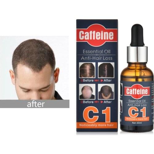 2 IN 1 Hair Growth Essence Anti Hair Loss Essential Oil Shampoo Preventing Hair Loss Damaged Hair Repair Hair Care Product