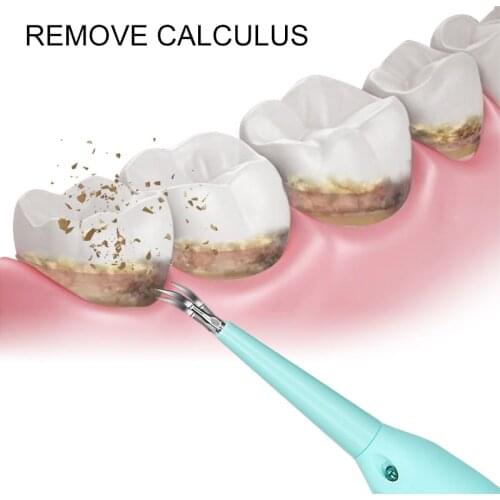 Portable Electric Sonic Dental Scaler Tooth Calculus Removal Teeth Stains Tartar USB Charge Dentist Whiten Teeth Health Hygiene