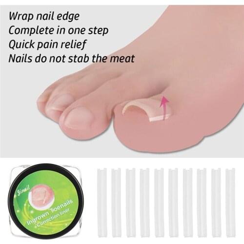 12Pcs/Set Ingrown Toe Nail Correction Sticker Patch Paronychia Correction File Wire Corrector Foot Care Treatment Tool