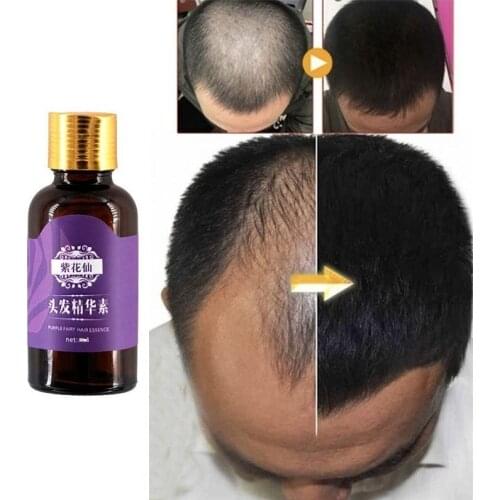 3PCS Hair Loss Products Natural With No Side Effects Grow Hair Faster Regrowth Hair Growth Products