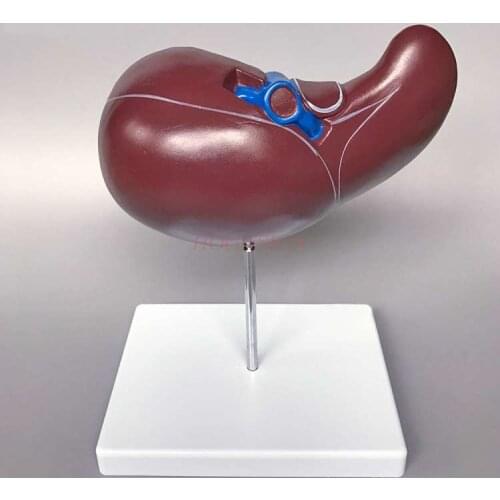 Hepatobiliary model Liver anatomy model Human liver blood vessels Hepatobiliary structure gallbladder bile duct display teaching