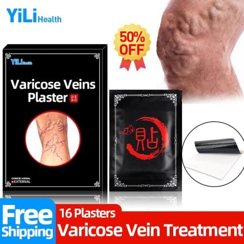 Varicose Veins Herbal Medical Plaster Treatment Vasculitis Inflammation Phlebitis Spider Legs Veins Cream Varicosity Patches