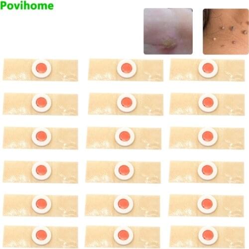 18/36/60pcs Soften Skin Cutin Sticker Wart Removel Plaster Anti Pruritus Corn Sticker Herbal Antibacterial Corn Bunion Bandage