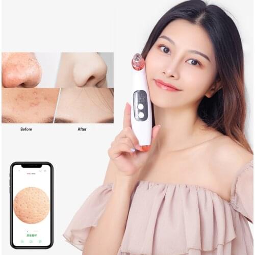 Vacuum Suction Blackhead Remover Nose Facial HD Micro Camera Visual Blackhead Removal Acne Dead Beauty Wifi Face Skin Care
