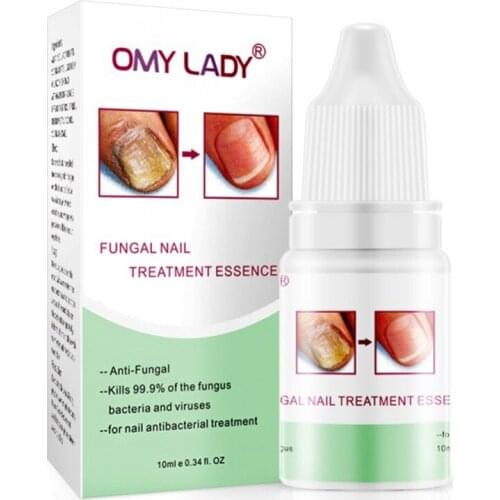 10ml Nail Repair Liquid Effective Against Nail Fungus Onychomycosis Removal Serum Nail Treatments