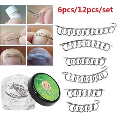 6/12Pcs Ingrown Toenail Correction Wire Fixer Foot Care Pedicure Recover Tool