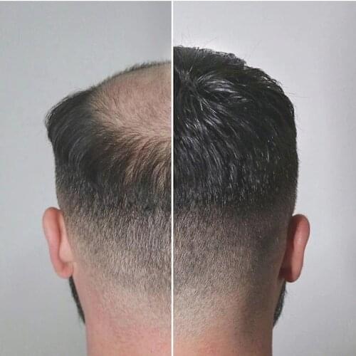 Silky Straight Natural Black Human Hair Mens Toupee Mono Base With PU Straight Hair Pieces For Man 6x8 7x9 cm Hair Piece