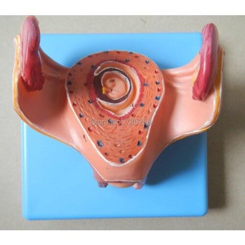 A Month of Pregnancy Embryo Model,Early Pregnancy Embryo Development Model