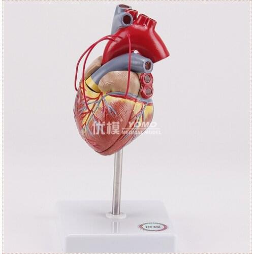 1:1 Human heart bypass model Pathological heart Anatomical model free shipping