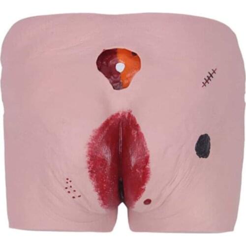 Pressure Ulcers Bedsore Nursing Model Bedsore Model Practical Props Medicine Student Medical Scnce Teaching Souierces Supply